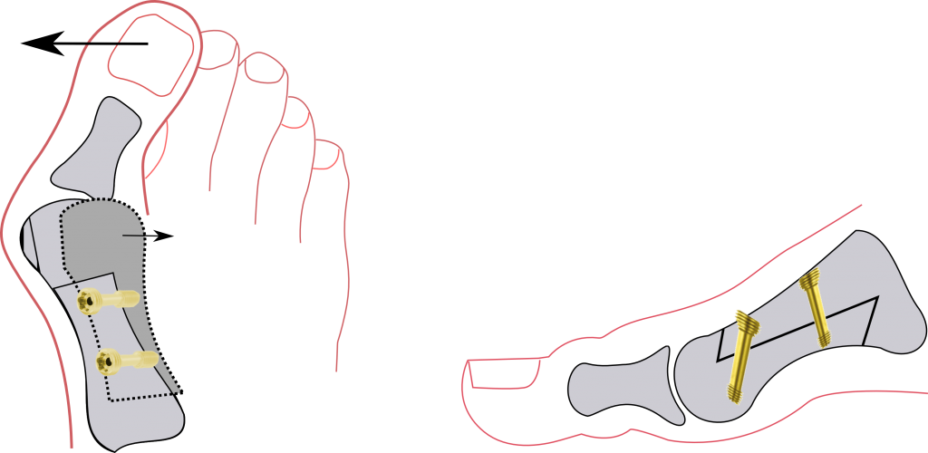 52144382_150219_1338_26.png 52144382_150219_1338_26.png