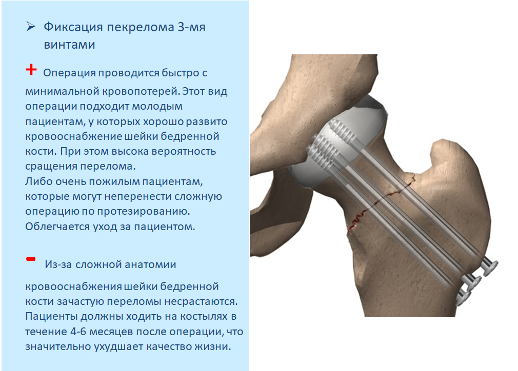 Схема цито травматология