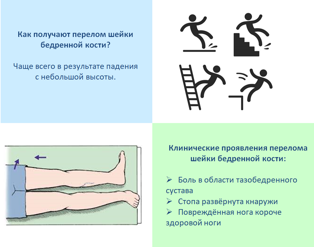 План сестринских вмешательств при переломе шейки бедра